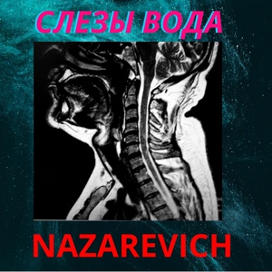 Обложка для NAZAREVICH - Слёзы вода